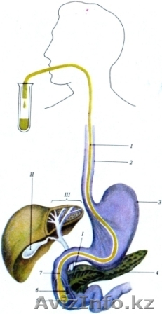  Дуоденальное зондирование - Изображение #1, Объявление #920971