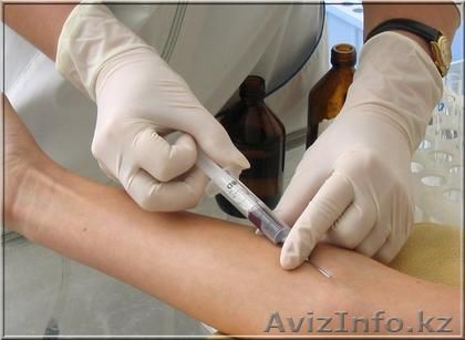 СТАВЛЮ ВСЕ ВИДЫ УКОЛОВ И КАПЕЛЬНИЦ - Изображение #1, Объявление #1219167