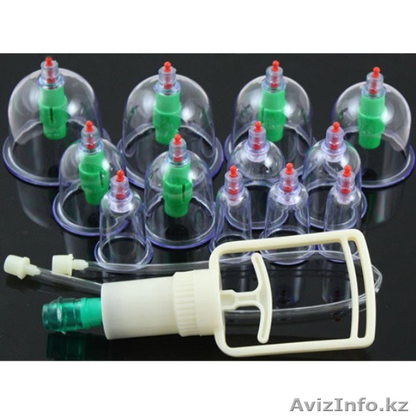 Массажные вакуумные банки 12 шт 14024 - Изображение #1, Объявление #1299288