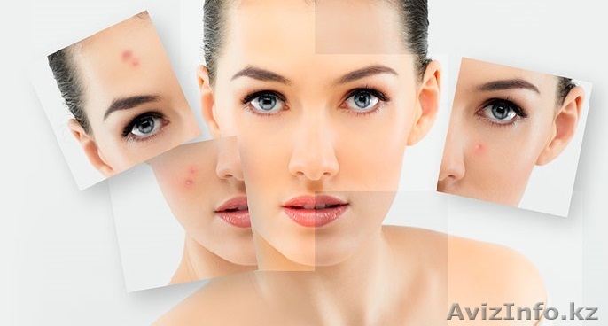 Дерматолог Алматы - Изображение #1, Объявление #1350274