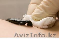 Лечение пиявками в Алматы (Апи плюс) - Изображение #1, Объявление #1357416