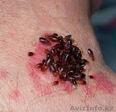 Уничтожение клопов в Алматы. Борьба с клопами. - Изображение #1, Объявление #1397472