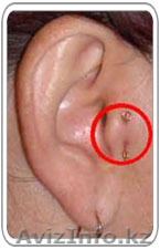 Минус лишние килло!! - Изображение #1, Объявление #1524799