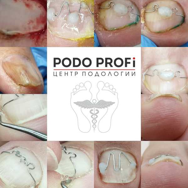 Ноги - наше всё - Изображение #1, Объявление #1670391