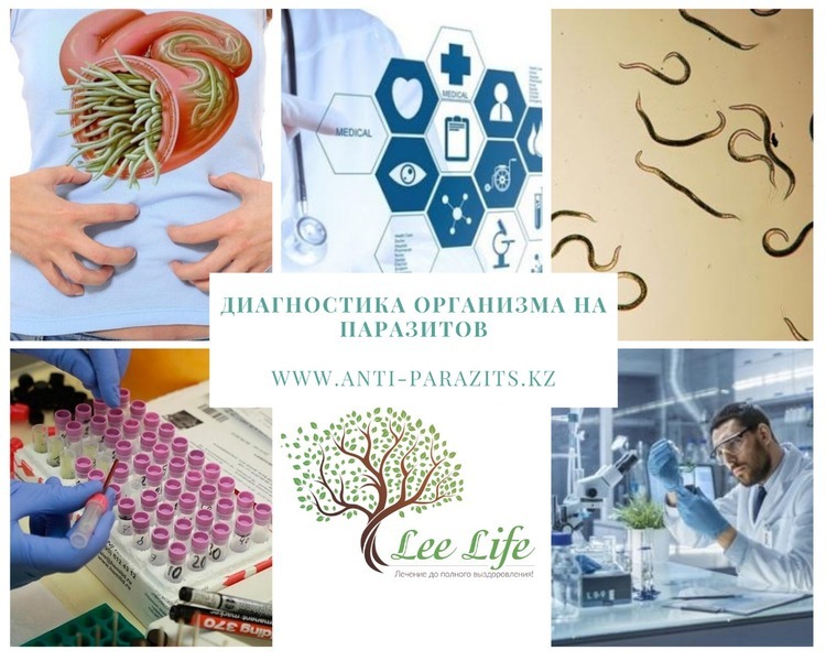 Комплексная диагностика организма на паразитов. - Изображение #1, Объявление #1689437