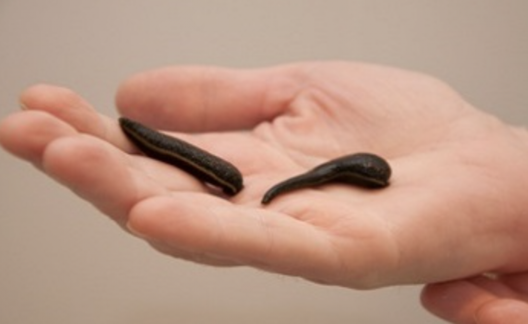 Лечение пиявками у вас дома!!!  - Изображение #1, Объявление #761658