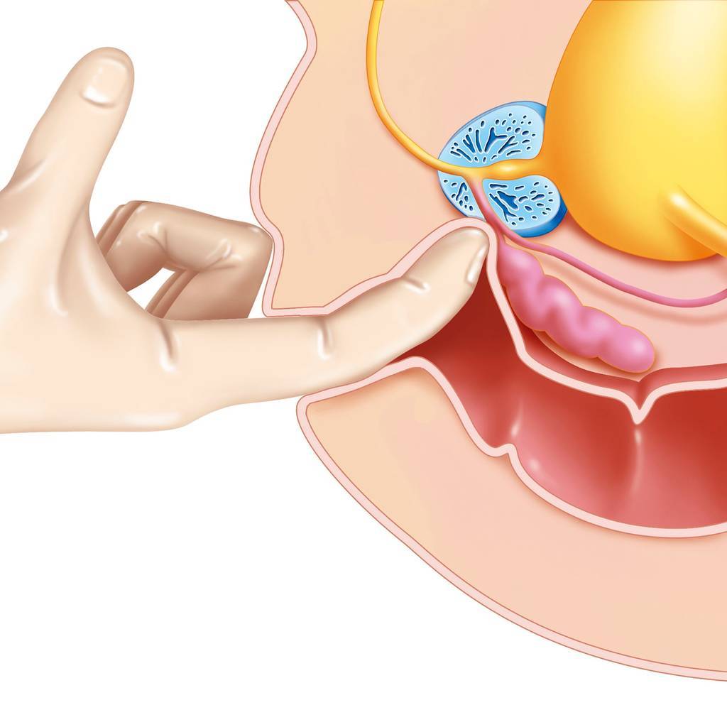 Массаж простаты, урологический массаж, обучающие курсы - Изображение #1, Объявление #1749377