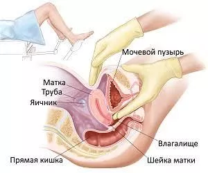 Обучение массажу матки или гинекологический массаж - Изображение #1, Объявление #1749376