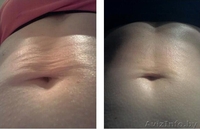 Аппарат Nu Skin BODY Galvanic (Гальваник СПА)  США. В Казахстане - Изображение #7, Объявление #648381