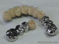 Установки  покрытия зубных протезов  "под золото"  из Беларуси - Изображение #4, Объявление #850572