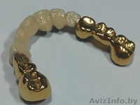 Установки  покрытия зубных протезов  "под золото"  из Беларуси - Изображение #5, Объявление #850572