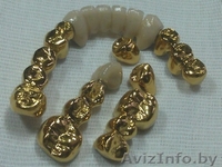 Установки  покрытия зубных протезов  "под золото"  из Беларуси - Изображение #9, Объявление #850572