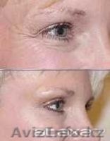 Гель Миллениум.ЭФФЕКТИВНОЕ СРЕДСТВО ОТ ПРЫЩЕЙ. - Изображение #2, Объявление #270937