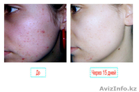 Гель Миллениум.ЭФФЕКТИВНОЕ СРЕДСТВО ОТ ПРЫЩЕЙ. - Изображение #7, Объявление #270937