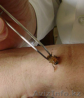 МЦ "АПИ+" апитерапия, гирудотерапия  - Изображение #2, Объявление #670162