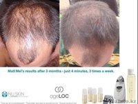 Аппарат Nu Skin Galvanic Spa (Гальваник СПА) технология из США в Казахстане!  - Изображение #7, Объявление #648379