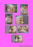 косметология и китайский точечный массаж   - Изображение #2, Объявление #55399