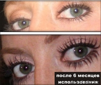 lurey lash md средство для роста ресниц и бровей. - Изображение #4, Объявление #924845