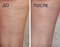 оздоровительный массаж (выезд с кушеткой) - Изображение #3, Объявление #972582