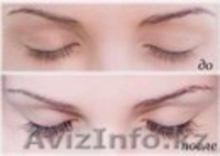Careprost-средство для роста ресниц - Изображение #4, Объявление #1038769