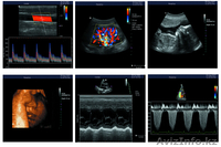 Портативный цветной 3D Допплер ультразвуковой аппарат (УЗИ) С7 - Изображение #4, Объявление #1126278
