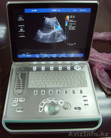 Портативный цветной 3D Допплер ультразвуковой аппарат (УЗИ) С7 - Изображение #1, Объявление #1126278