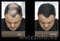 Загустители волос ТОППИК,FIXPLANT,EFFICIENT по самым низким ценам  - Изображение #4, Объявление #1124485