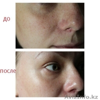 ZEITGARD (Цайтгард) - Умный немецкий гаджет для очищения лица - Изображение #7, Объявление #1461500