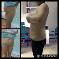 Байбосунов Данияр Алмазбекович пластический хирург - Изображение #3, Объявление #1650226