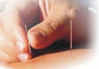 Иглорефлексотерапия в Алматы - Изображение #5, Объявление #1663653