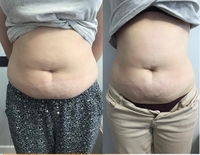 ИЗБАВЬСЯ ОТ ЦЕЛЛЮЛИТА И ЖИРОВЫХ ОТЛОЖЕНИЙ БЕЗОПАСНО И ЭФФЕКТИВНО! - Изображение #5, Объявление #1665699