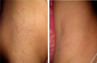 Шугаринг. Сахарная эпиляция. Персидская эпиляция - Изображение #3, Объявление #1684301