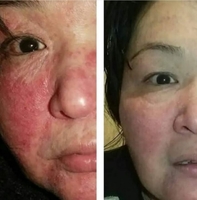 Продам шунгитовое лечебное мыло - Изображение #4, Объявление #1701106