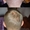 Пересадка волос методом FUE. Трансплантация волос в Турции. Восстановление волос - Изображение #2, Объявление #1328379
