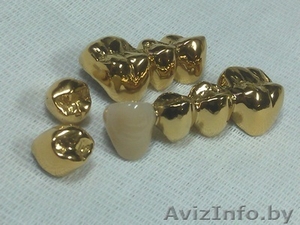 Установки  покрытия зубных протезов  "под золото"  из Беларуси - Изображение #10, Объявление #850572
