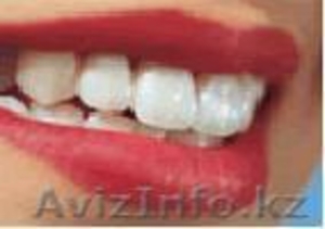 Круглосуточная стоматологическая клиника "Perfect Stom" - Изображение #1, Объявление #763438