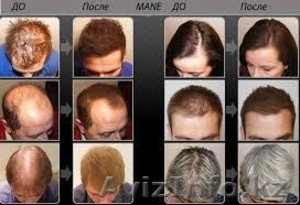 Загустители волос ТОППИК,FIXPLANT,EFFICIENT по самым низким ценам  - Изображение #1, Объявление #1124485