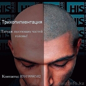Трихопигментация в Казахстане  - Изображение #4, Объявление #1481932