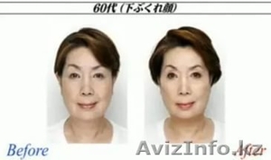 Японский массаж лица «АСАХИ». Уберу провисшие щеки, 2 подбородок - Изображение #2, Объявление #1280381