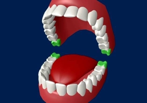Стоматолог + 3D снимок (визиограф) 24/7 - Изображение #4, Объявление #1729783