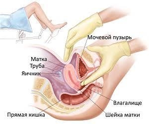Обучение массажу матки или гинекологический массаж #1749376