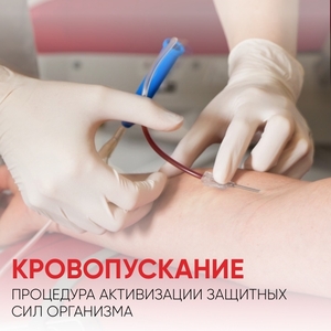 Гемоэксфузия для разжижения густой крови — прием ведет хирург  