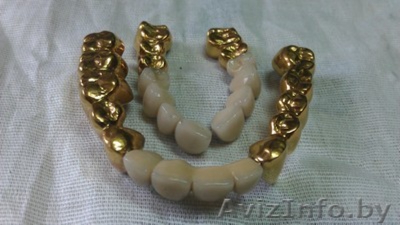 Установки  покрытия зубных протезов  "под золото"  из Беларуси - Изображение #8, Объявление #850572