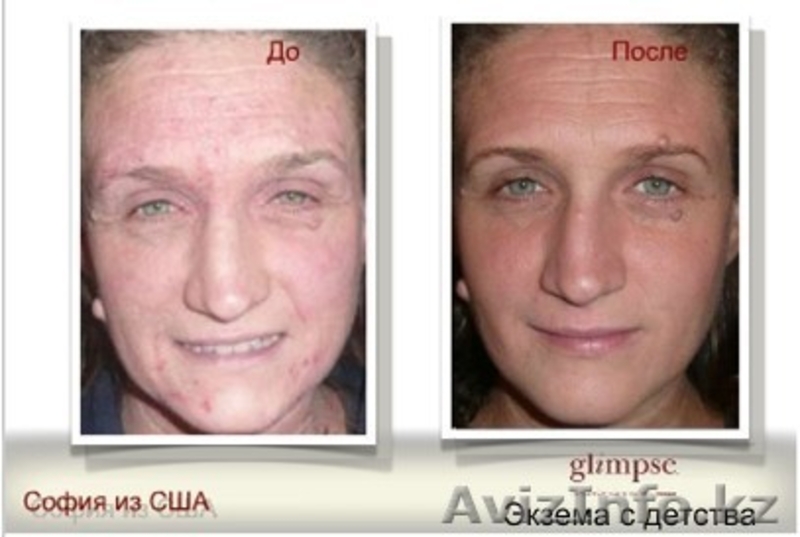 Косметика Glimpse  - Изображение #4, Объявление #118212