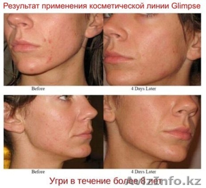 Косметика Glimpse  - Изображение #5, Объявление #118212