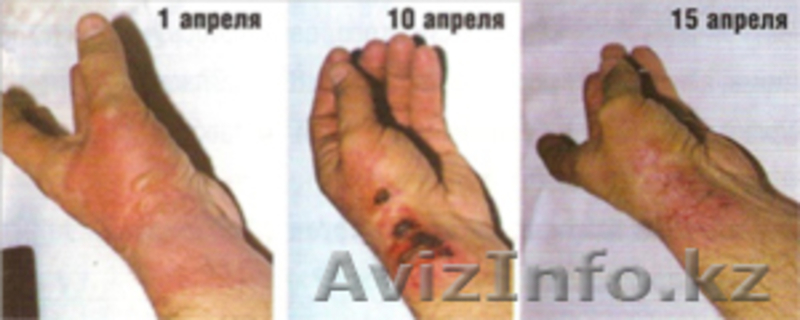 КРЕМ ОТ МОРЩИН НА ОСНОВЕ ГИАЛУРОНОВОЙ КИСЛОТЫ.ГЕЛЬ МИЛЛЕНИУМ ОТ ВИЗИОН. - Изображение #2, Объявление #335778