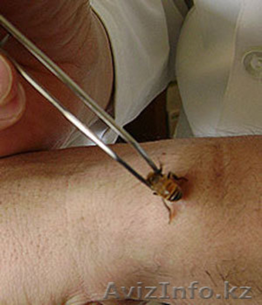 МЦ "АПИ+" апитерапия, гирудотерапия  - Изображение #2, Объявление #670162