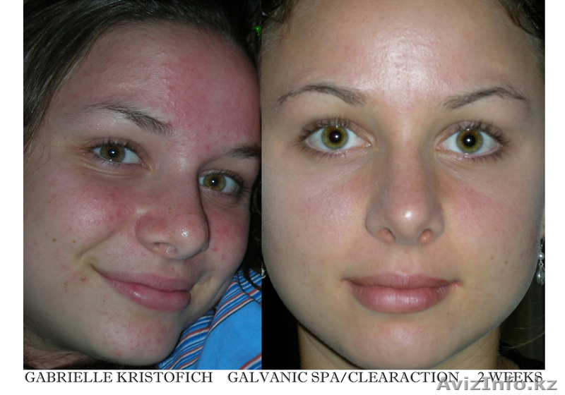 Аппарат Nu Skin Galvanic Spa (Гальваник СПА) технология из США в Казахстане!  - Изображение #5, Объявление #648379