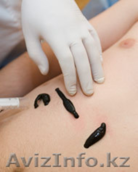 МЦ "АПИ+" апитерапия, гирудотерапия  - Изображение #1, Объявление #670162