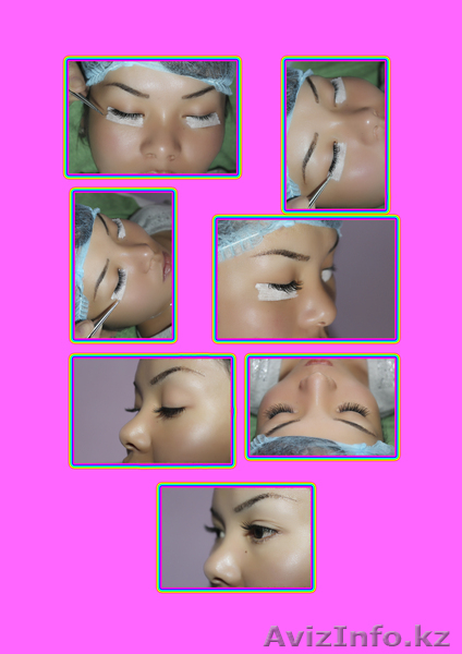 косметология и китайский точечный массаж   - Изображение #2, Объявление #55399